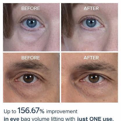 Dr.Melaxin Eyephalt Eyebag Cream